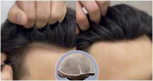 Bono Hair hair system