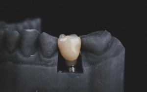 Cosmetic Dentistry at Renaissance Dental