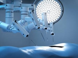 Synchronized Placement Of Surgical Implant Hardware