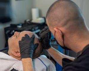 Creating the illusion of hair by performing a non invasive treatment that uses detailed micro-needles to deposit pigment into the scalp. Also called SMP