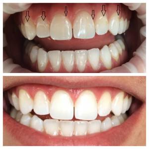 General dentistry, comprehensive dental care, professional teeth cleaning, preventative oral health, tooth decay, gum disease treatment, oral cancer screening, fillings, extractions, oral health maintenance, qualified dentist, personalized care