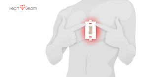 HeartBeam medical grade heart attack detection