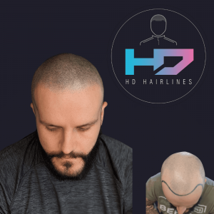 HD Hairlines 1
