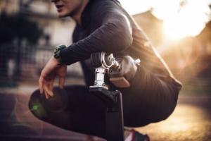 Prosthetic Connector Market