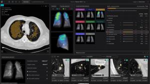 This is an image of the user interface for contextflow ADVANCE Chest CT, an AI-based medical device software for radiologists reading reports for chest CTs.