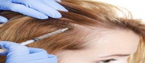 Alopecia Treatment Market LinkedIN