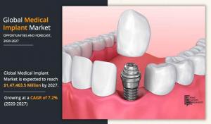 Medical Implant Market Share