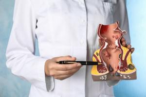 Anal Fistula Treatment Market - PMI