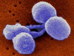 Conjugate Vaccine Market