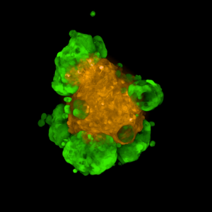 Fluorescent image of a 3D tumor microtissue
