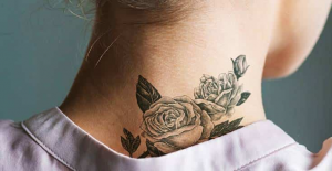 Tattoo Removal Market