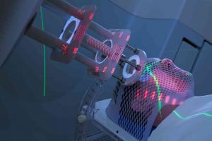 North America Medical Laser Systems Market Reach US$ 2,257.13 million by 2028 at 13.7% CAGR