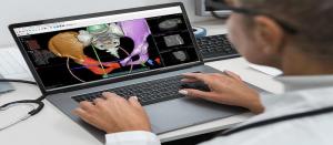 Preoperative Surgical Planning Software Market1
