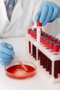 Blood Collection Systems Market