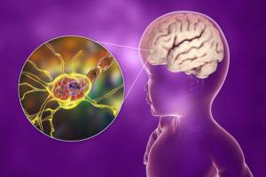 GM2 Gangliosidosis Market-PMI