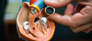 Artificial heart valve Market