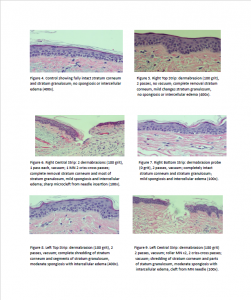it shows a series of 8 histopathological analysis of skin samples post different sessions of MIRApeel using different sets of parameters, serums and power settings
