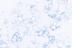 Nanocellulose Market- insightSLICE