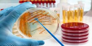 Microbial Testing Market1