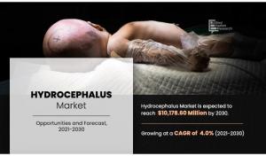 hydrocephalus industry 2030