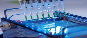 Bioseparation Systems Market1