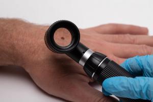 Dermatoscope Market to Grow US$ 2,217.2 Mn at a CAGR of 12.85% by 2030