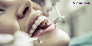 Full-mouth Dental Implants are revolutionising teeth replacement in India. Summirow Dental Hospital, based in Surat, is such a service provider. Led by Dr Ushma Kakkad, the dental hospital gives patients a restored smile in three days with better oral hea
