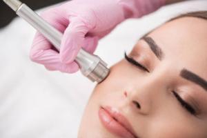 Microdermabrasion Devices Market Size To Reach US$ 886.57 Million By 2030