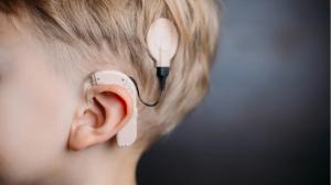 Cochlear Implants Market