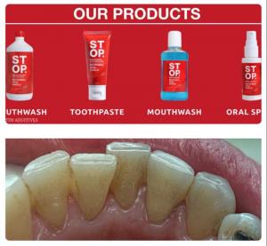 STOP Oral Care products