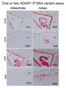 Flipons help ADAR1 turn off inflammation