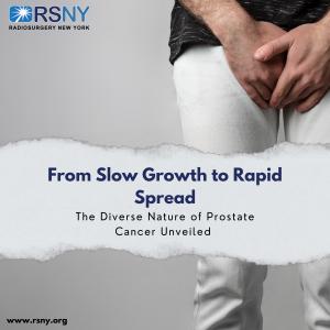 RSNY - Slow Growth to Rapid Spread