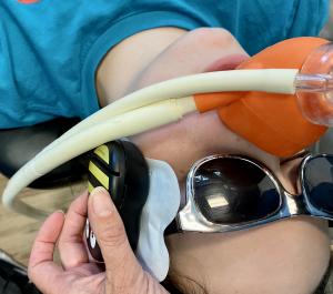 Girl getting dental procedure, Buzzy applied to maxilla, nitrous oxide administered