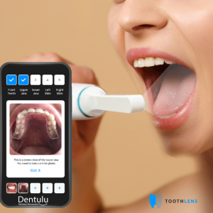 Dentulu Expands Dental Artificial capabilities through strategic partnership w/ Toothlens Revolutionizing Teledentistry