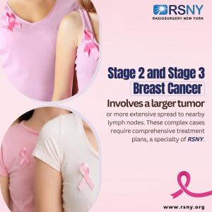 Stage 2 and Stage 3 of Breast Cancer