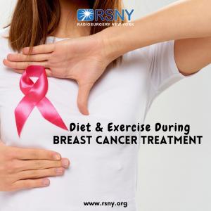 Diet & Exercise During Breast Cancer Treatment
