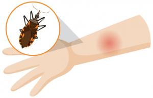 chagas disease treatment size