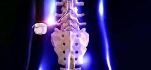 Spinal Trauma Device Market