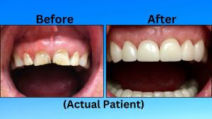 Cosmetic Dentistry The Gilbert Dentist