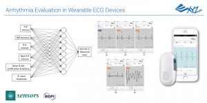 The optimized algorithm can reduce the need of the computing loading of the Microprocessor Control Unit (MCU) and make it possible to evaluate arrhythmia only via tiny wearable electrocardiogram (ECG) monitoring device.