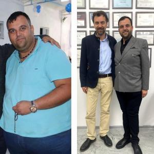 Prof. Dr. Cemal Kara with his patient before and after surgery