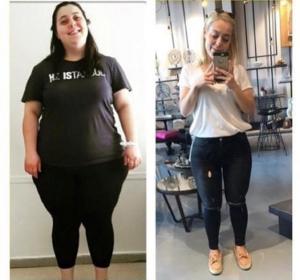 Obesity Surgery Specialist Prof.Dr. Serdar Kaçar said that obesity surgeries treat more than 7 diseases and provide society with individuals who can work and have high self-confidence.