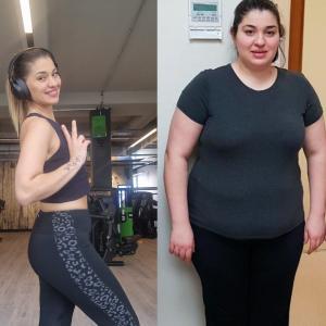 Prof. Dr. Kacar said that obesity surgeries treat more than 7 diseases and provide society with individuals who can work and have high self-confidence.