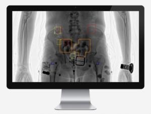 Druguard automated narcotics detection assistance software