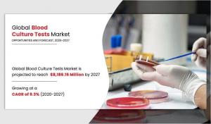 Blood Culture Test Market Expected to Reach .186 Billion by 2027 | CAGR of 9.3%