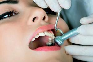 Dental Caries Treatment Market