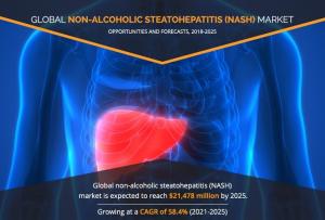 Non-alcoholic steatohepatitis (NASH) industry 2030