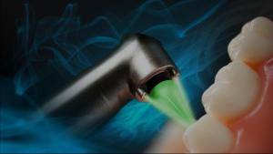 Laser Dental Cleaning in Gilbert AZ