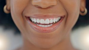 FirstClass Aligners: Now Offering Patient-Centric Care With Clear Aligners