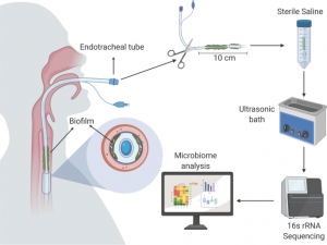 Europe Drug Coated Endotracheal Tube Market Size
